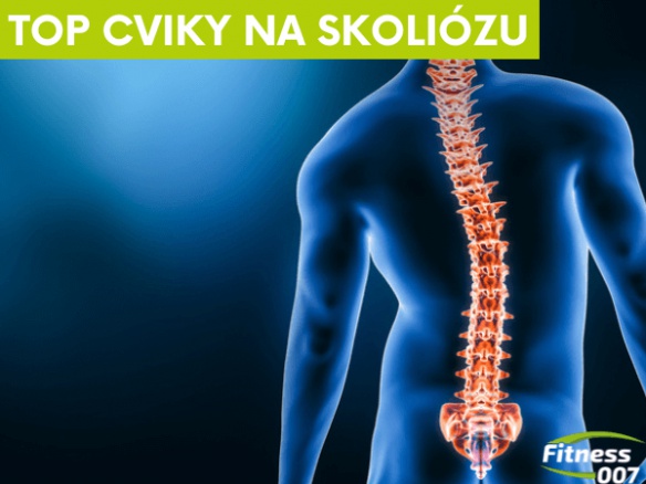 Jak pracovat se skoliózou? | Zkuste těchto 7 cviků na skoliózu