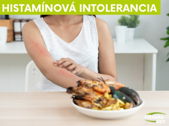 Histamínová intolerancia: Zradný zabijak pohody a energie? Petr Havlíček vysvetľuje všetko podstatné.